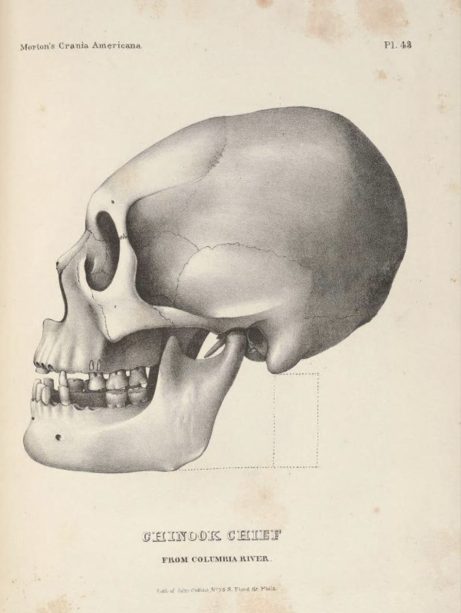 "Chinook Chief," in Morton, 1839